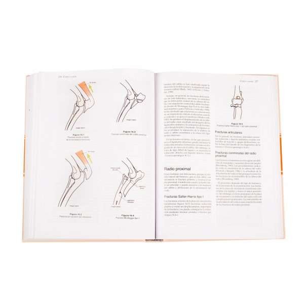 Manual de Reparación y Tratamiento de Fracturas - Imagen 4
