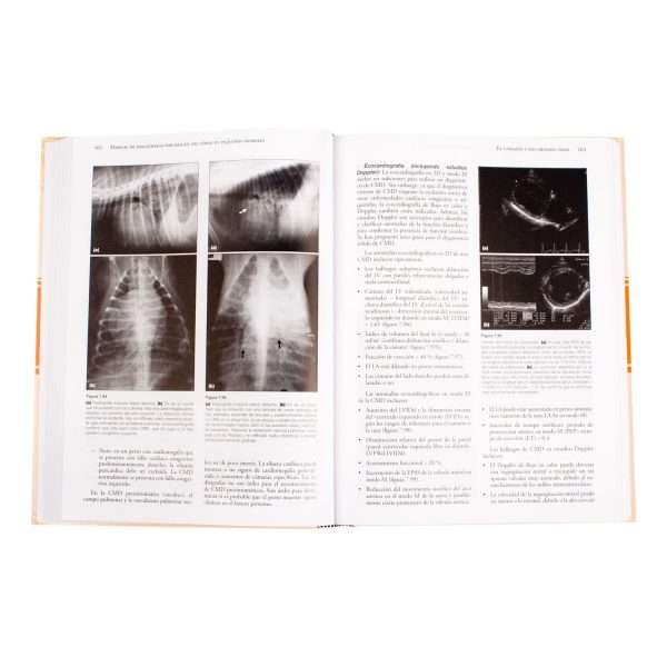 Manual de Diagnóstico por Imagen del Tórax - Imagen 3