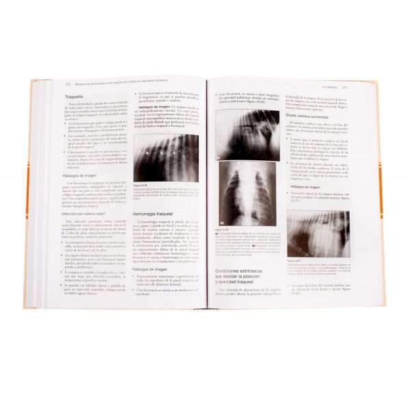 Manual de Diagnóstico por Imagen del Tórax - Imagen 4