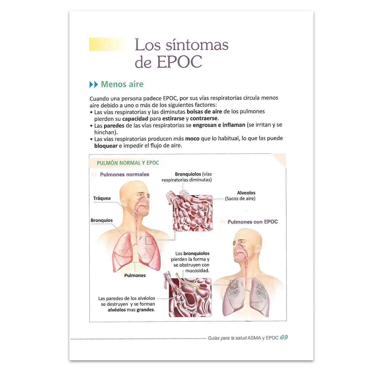 Asma y Epoc - Imagen 2