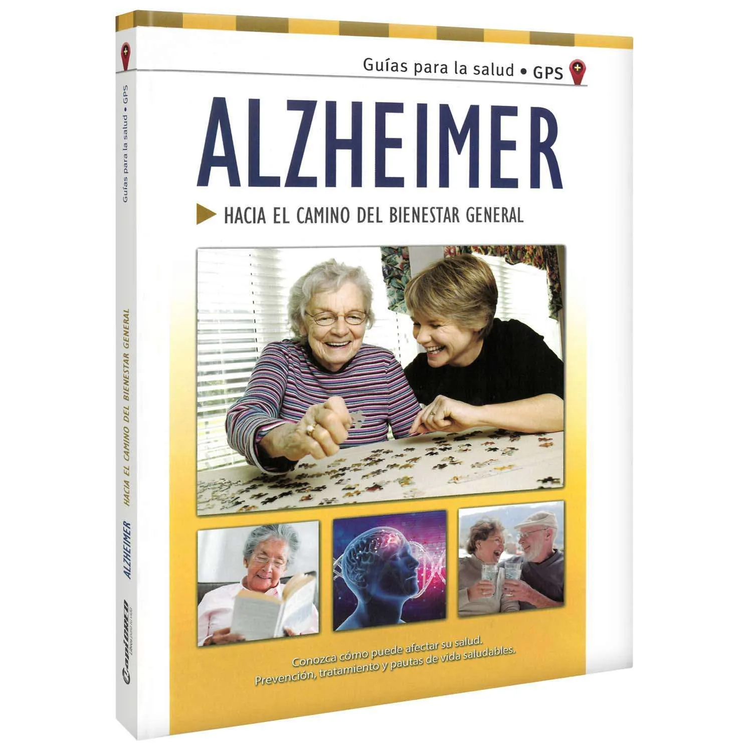 Alzheimer